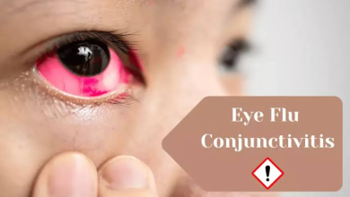Photo of कंजेक्टिवाइटिस (eye flu) में कोई भी ड्राप डालना खतरनाक: